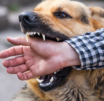 Dog bite attack